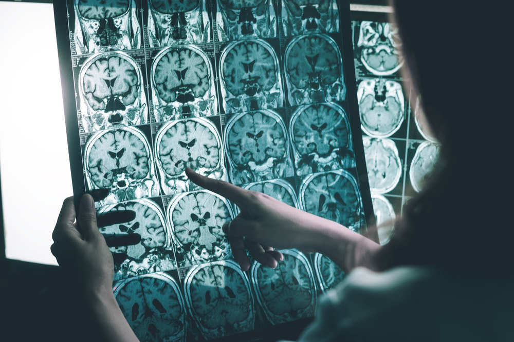 Senior patient undergoing cognitive evaluation with a healthcare professional during an Alzheimer’s diagnosis assessment.